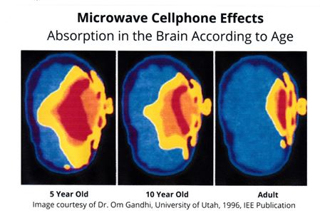 EMF Exposure Symptoms - Microwave Cellphone Effects