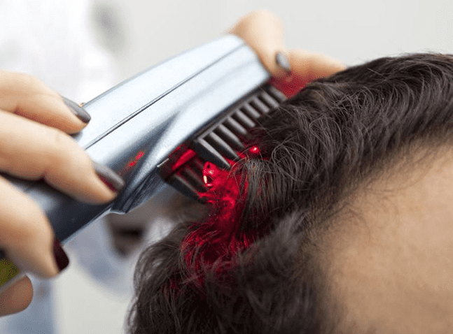 How to Find the Best Laser Hair Growth Device